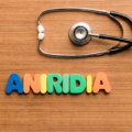 Aniridia: Guida Completa alle Alterazioni dell’Iride e Soluzioni Ottiche Personalizzate